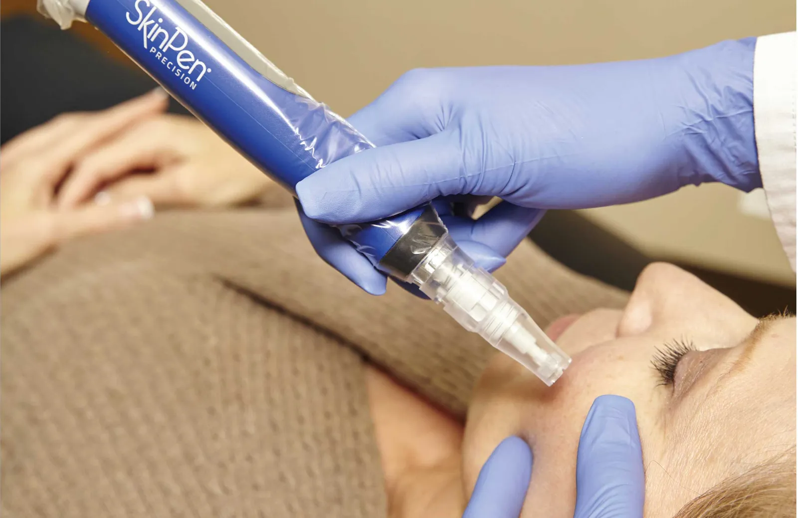 SkinPen microneedling