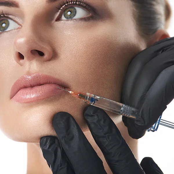 A hyaluronic acid filler injection in the lips