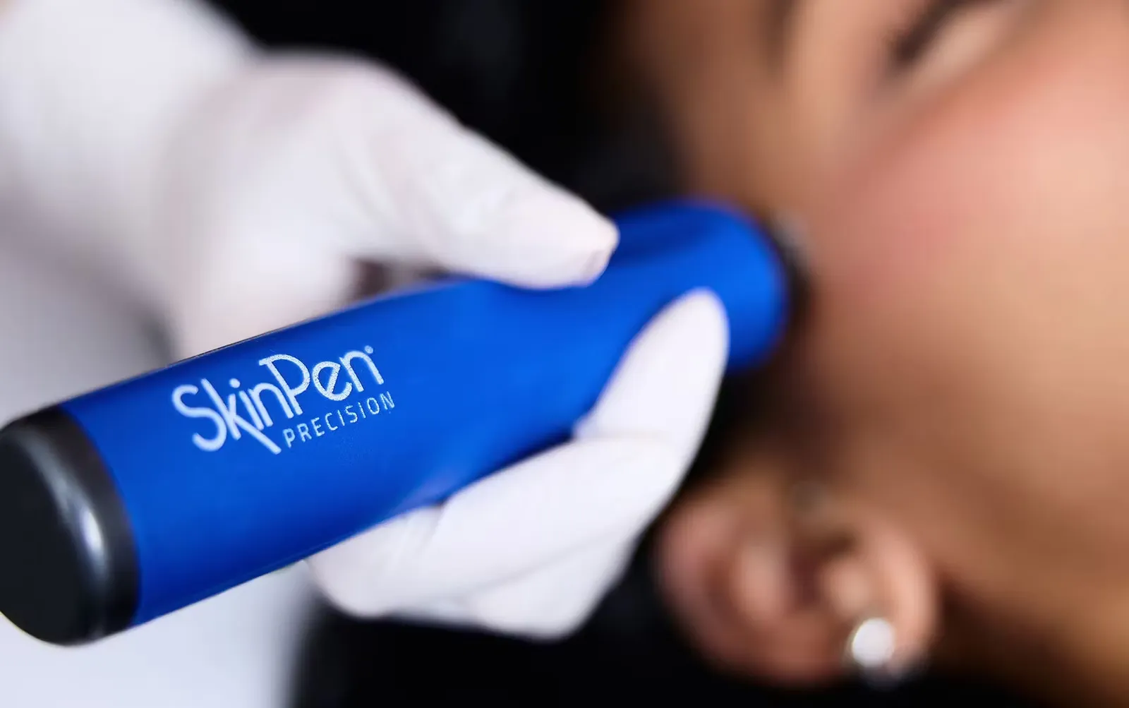 SkinPen microneedling